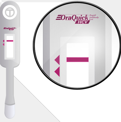 Test rapido HCV su saliva