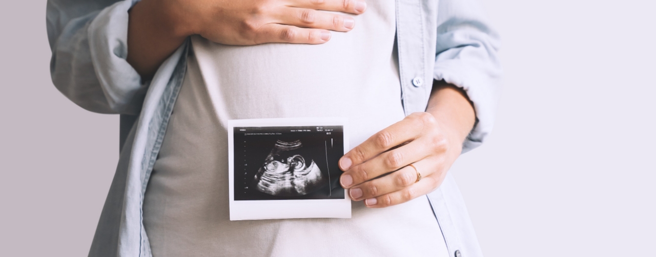 Diagnosi rapida delle cromosomopatie fetali mediante QF-PCR