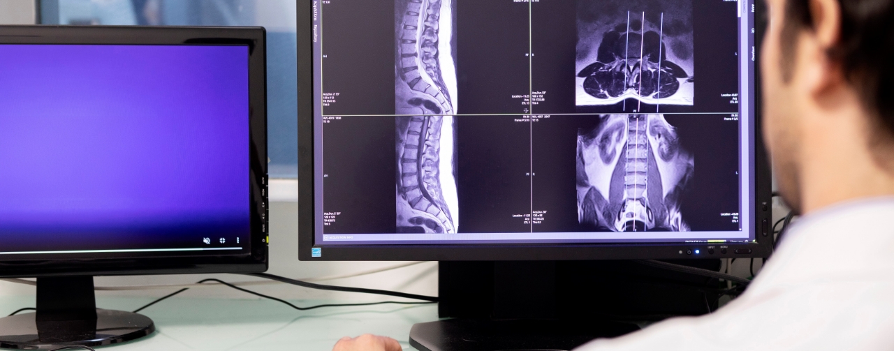 Risonanza magnetica aperta: a cosa serve e benefici
