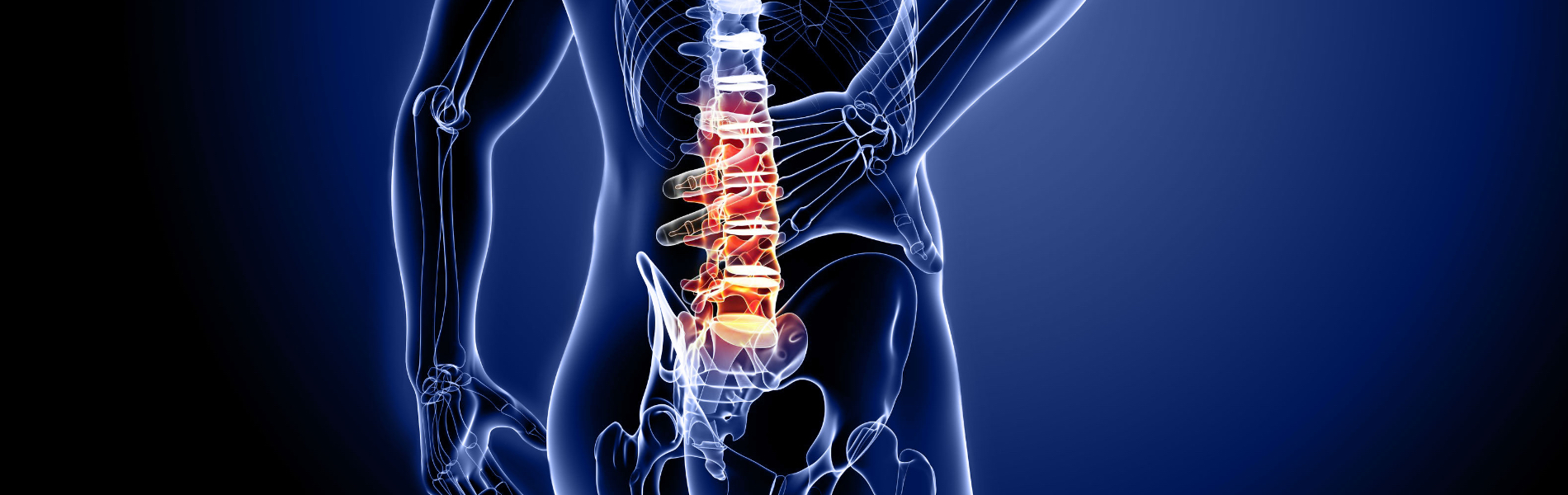 Rieducazione della Schiena - Back School