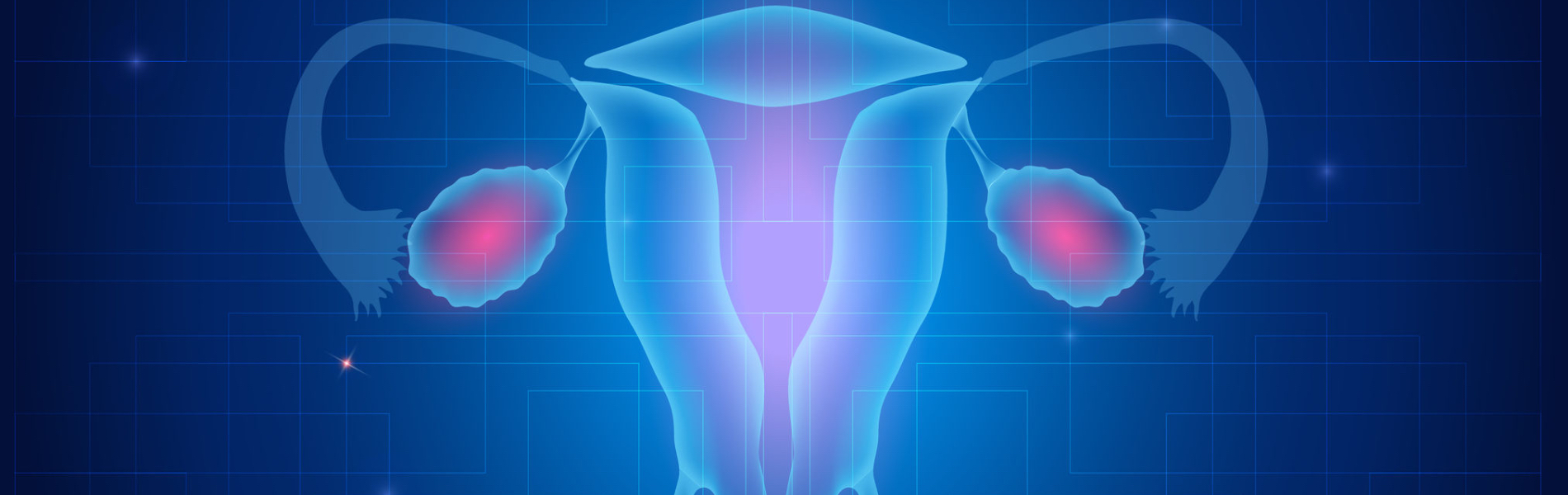 Test Marcatore Tumore Ovarico - H4