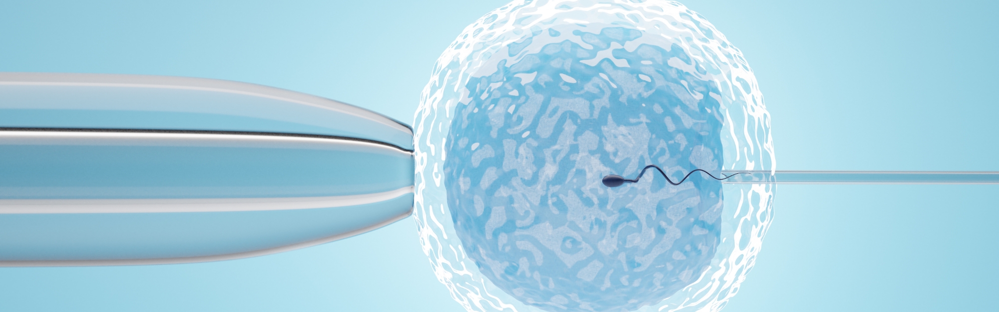 ICSI: iniezione intracitoplasmatica dello spermatozoo