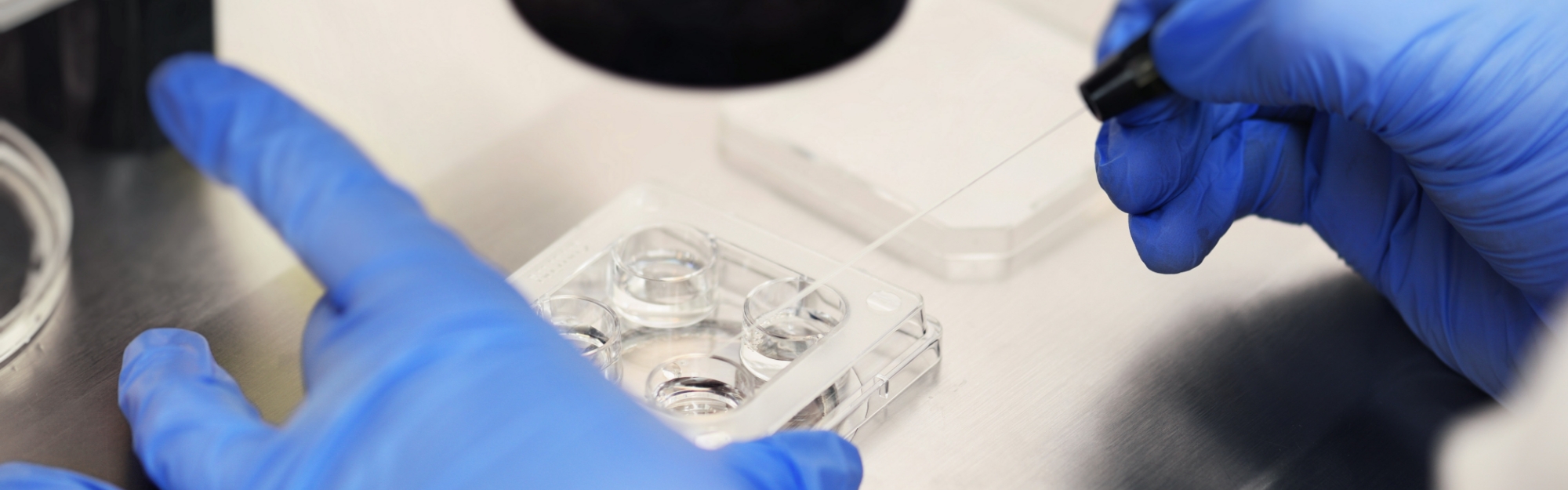 Tecniche di Inseminazione Artificiali