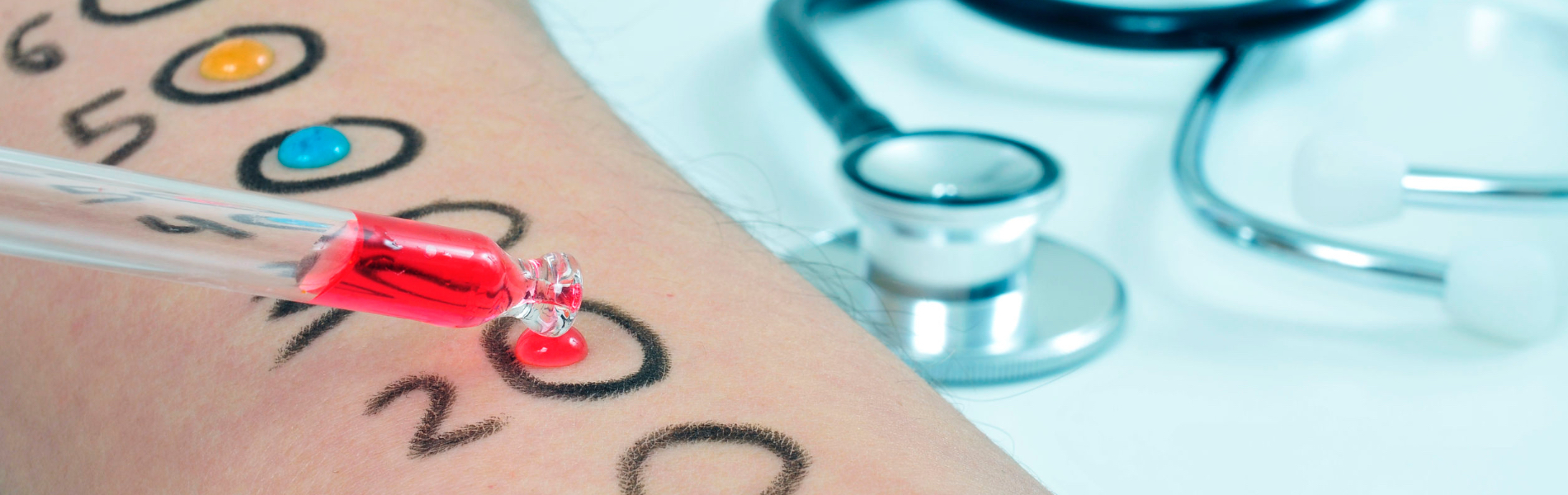 Test Allergologici Respiratori (Prick Test)