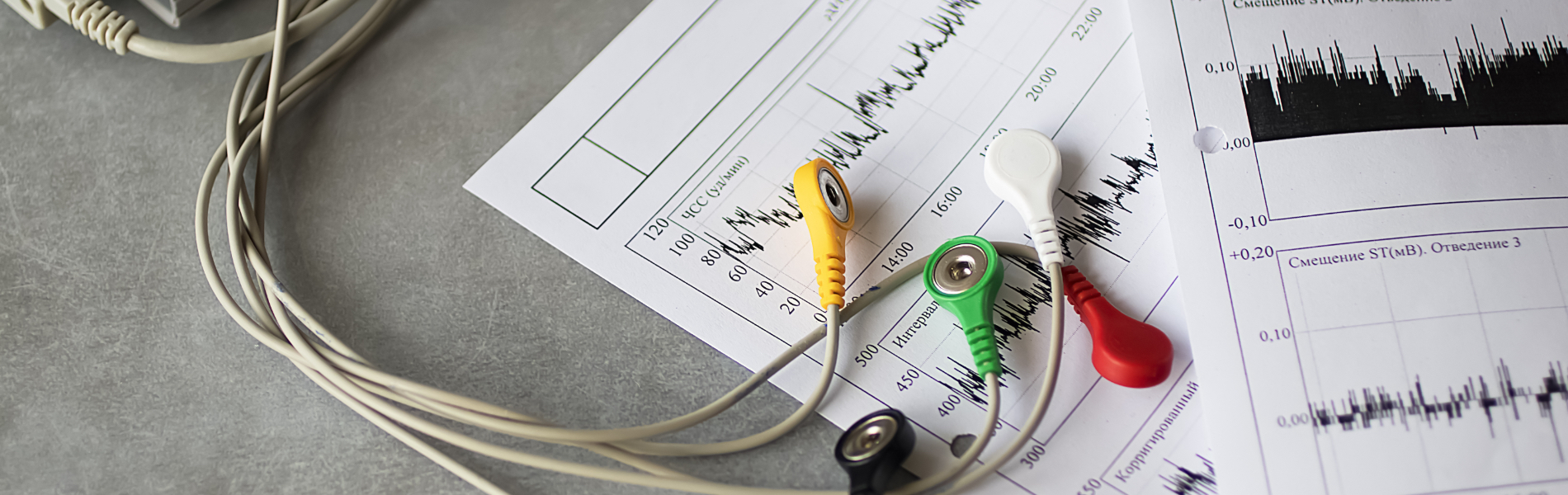 Elettrocardiogramma (ECG) Dinamico delle 24 Ore - Holter Cardiaco