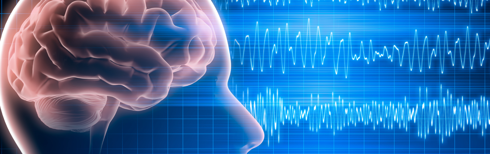 Elettroencefalogramma (EEG)