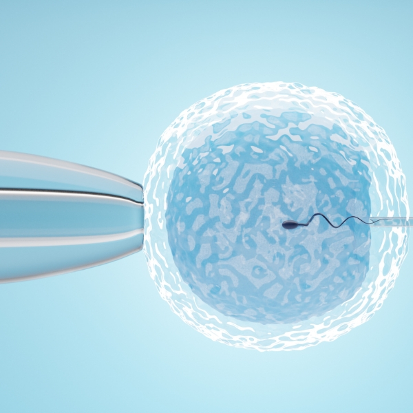 ICSI: iniezione intracitoplasmatica dello spermatozoo