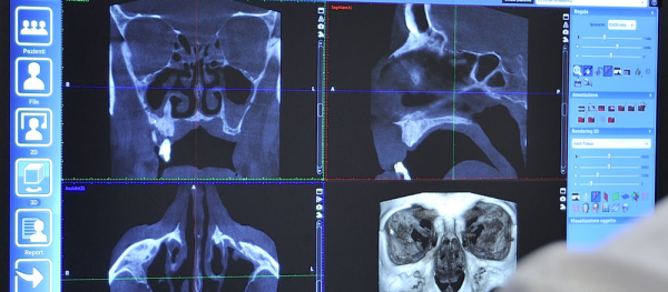 Radiologia Dentale e Telecranio
